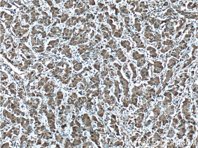 S100A4 Antibody in Immunohistochemistry (Paraffin) (IHC (P))