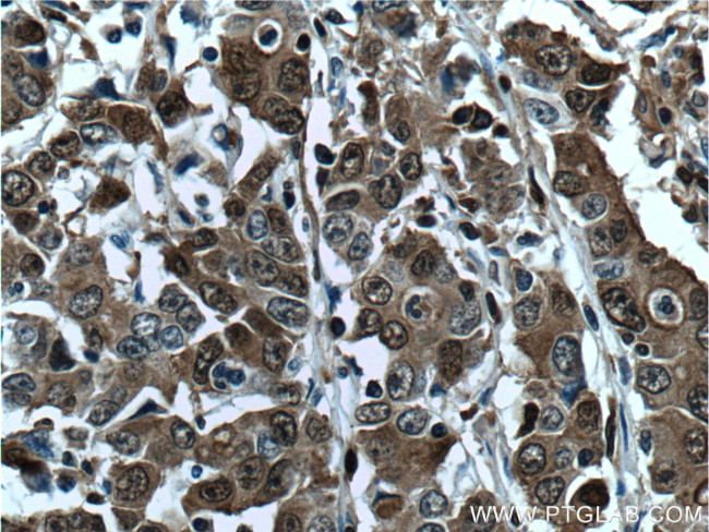 S100A4 Antibody in Immunohistochemistry (Paraffin) (IHC (P))