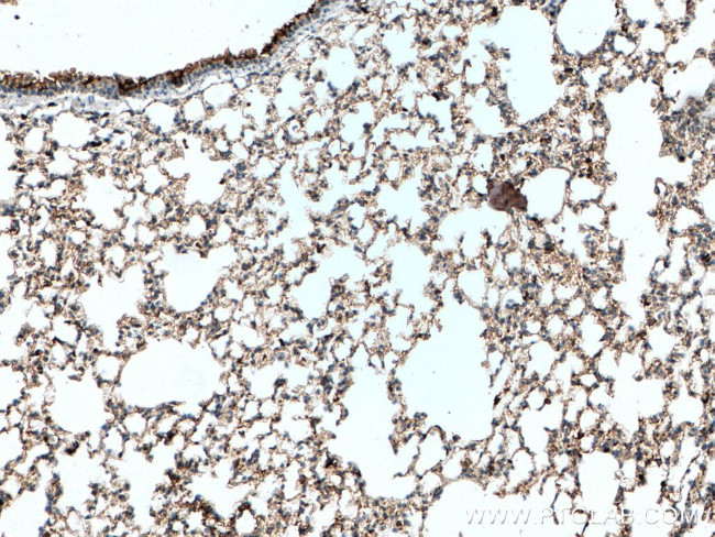 S100A4 Antibody in Immunohistochemistry (Paraffin) (IHC (P))