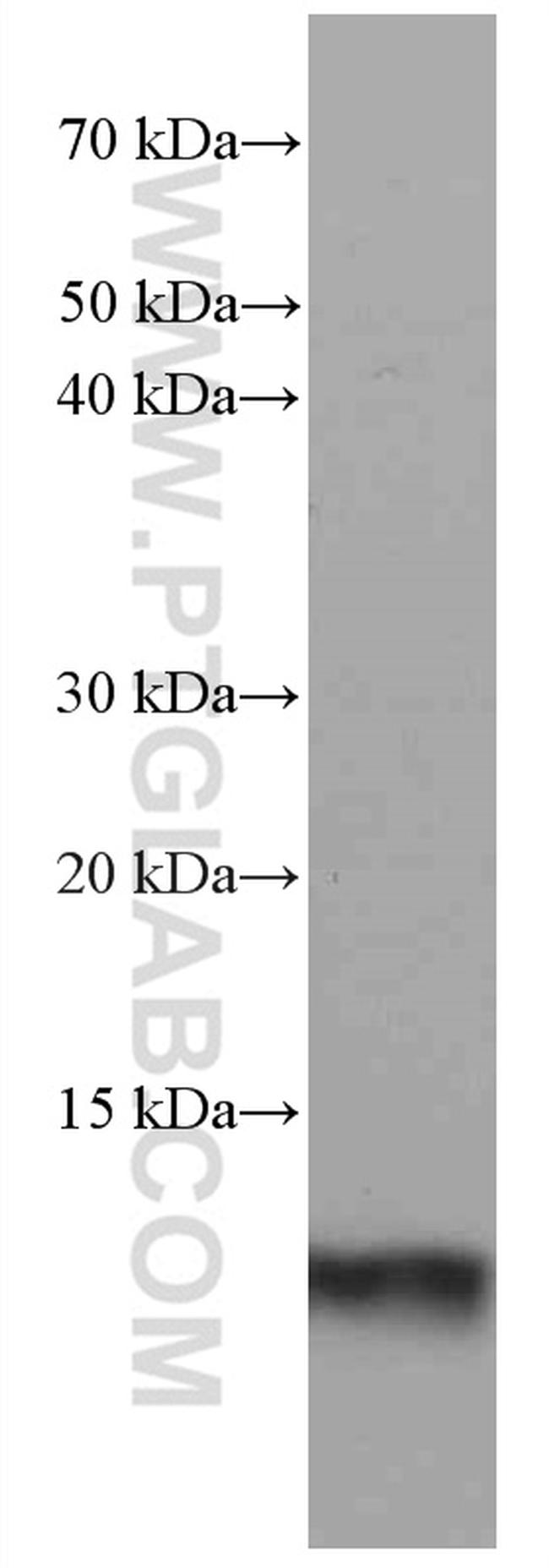 S100A4 Antibody in Western Blot (WB)