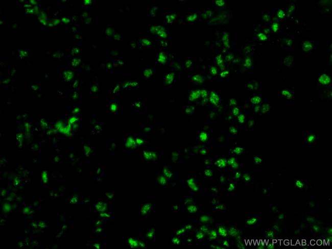 HRPT2/CDC73 Antibody in Immunohistochemistry (PFA fixed) (IHC (PFA))