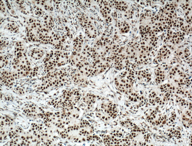 HRPT2/CDC73 Antibody in Immunohistochemistry (Paraffin) (IHC (P))