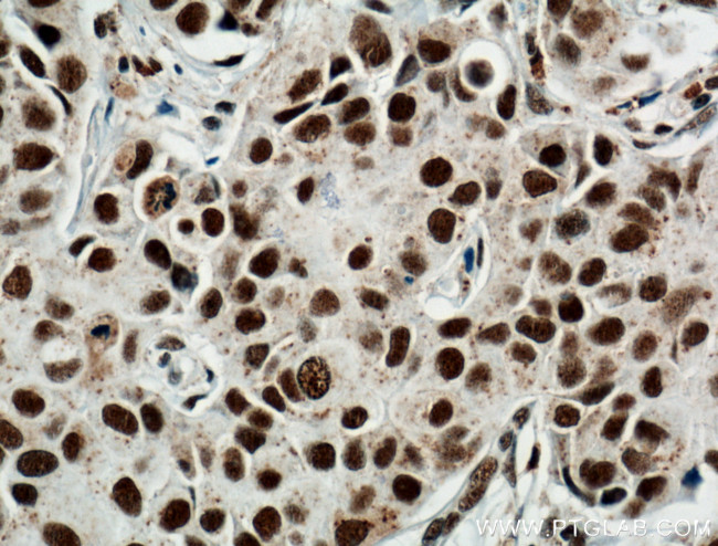 HRPT2/CDC73 Antibody in Immunohistochemistry (Paraffin) (IHC (P))