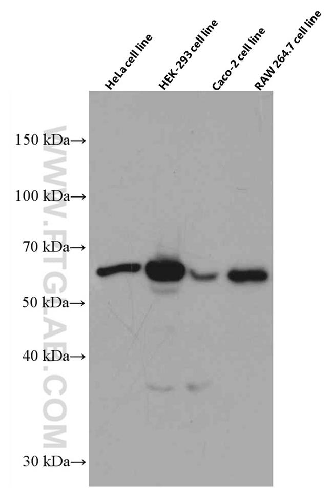 HRPT2/CDC73 Antibody in Western Blot (WB)