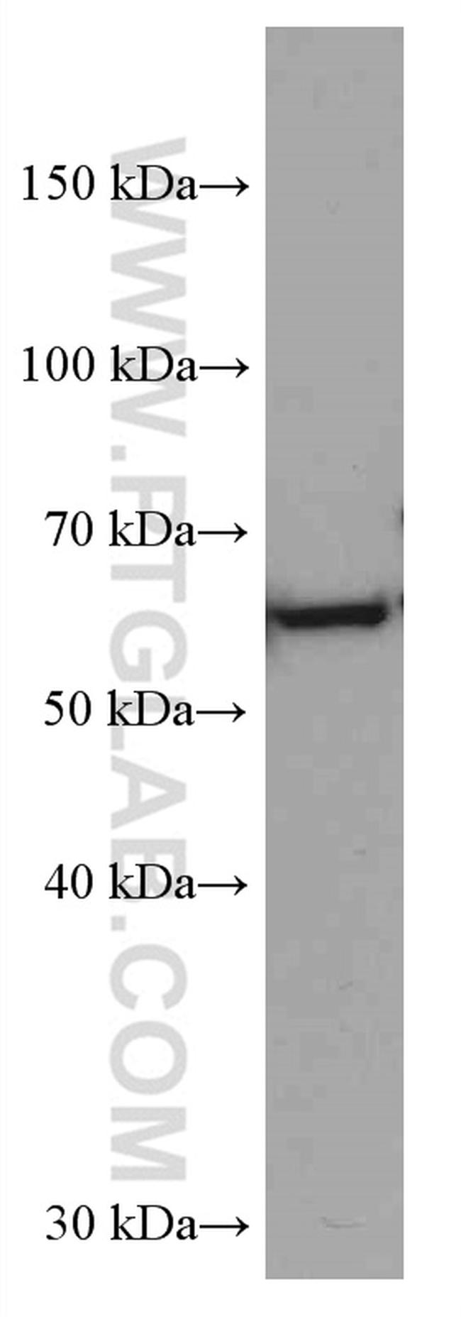 HRPT2/CDC73 Antibody in Western Blot (WB)