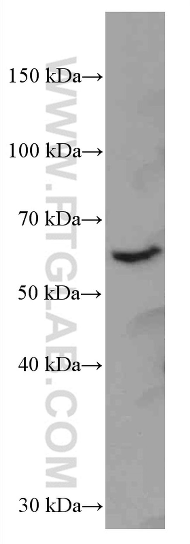 HRPT2/CDC73 Antibody in Western Blot (WB)