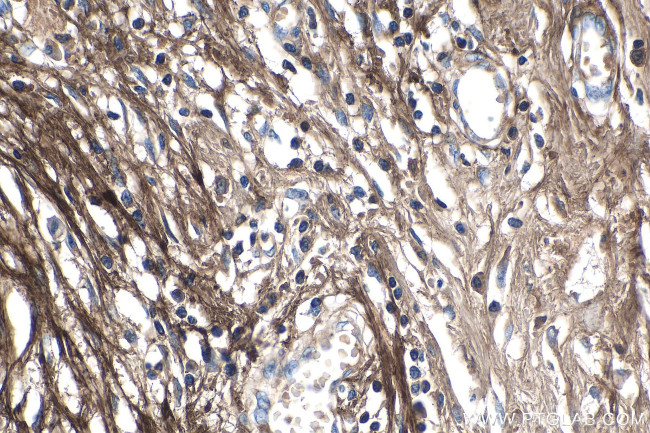 Periostin Antibody in Immunohistochemistry (Paraffin) (IHC (P))