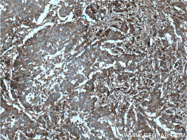 Periostin Antibody in Immunohistochemistry (Paraffin) (IHC (P))