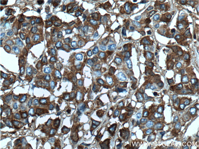 Periostin Antibody in Immunohistochemistry (Paraffin) (IHC (P))