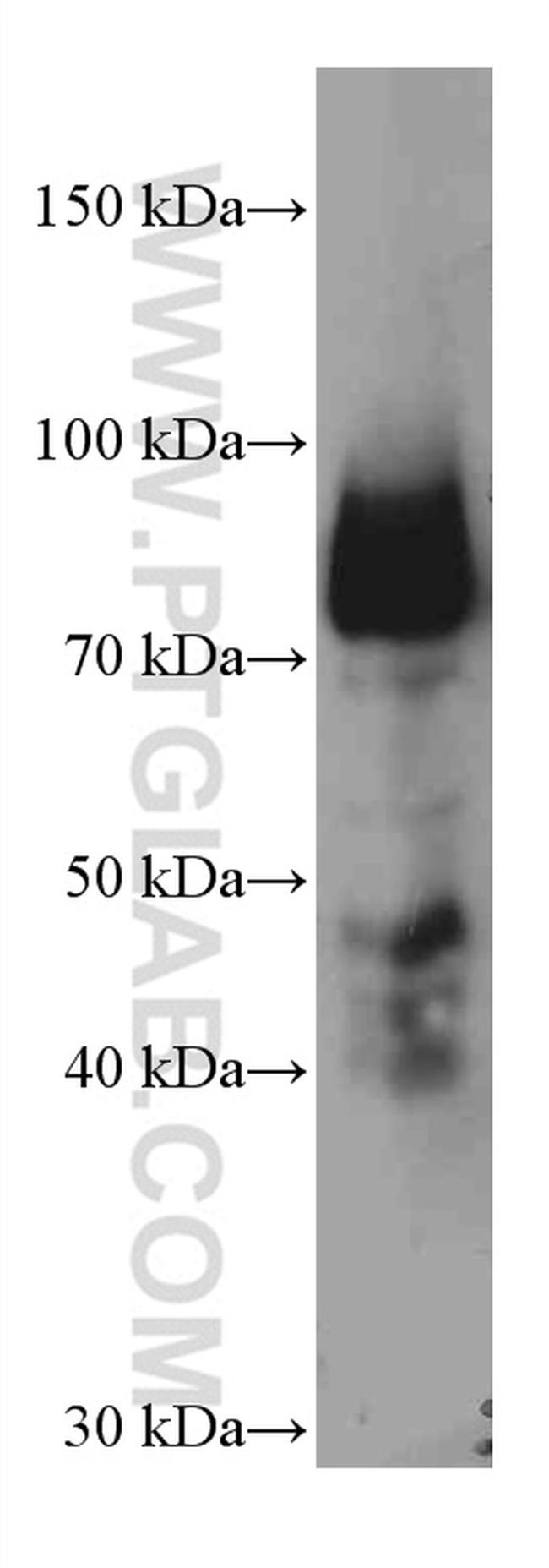 Periostin Antibody in Western Blot (WB)