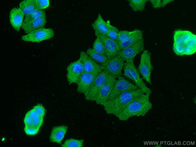 NRG1 Antibody in Immunocytochemistry (ICC/IF)