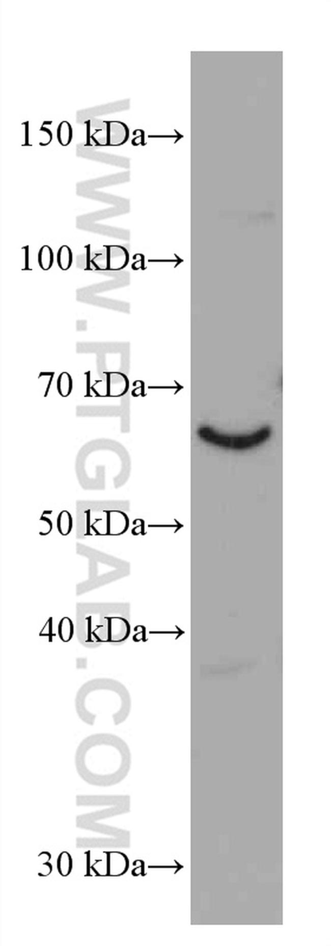 NRG1 Antibody in Western Blot (WB)