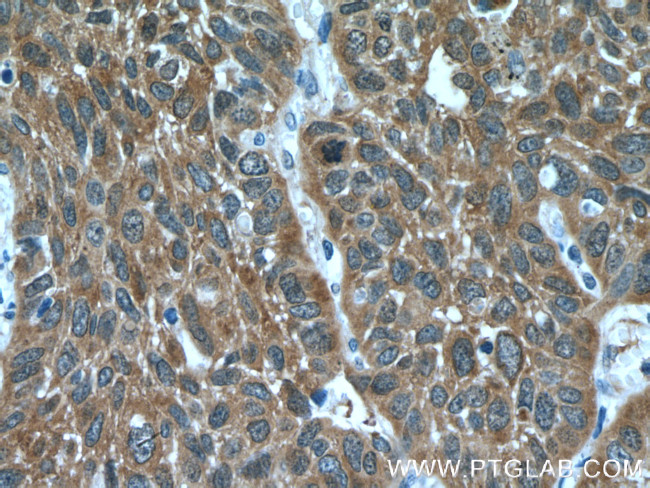 PKC iota Antibody in Immunohistochemistry (Paraffin) (IHC (P))