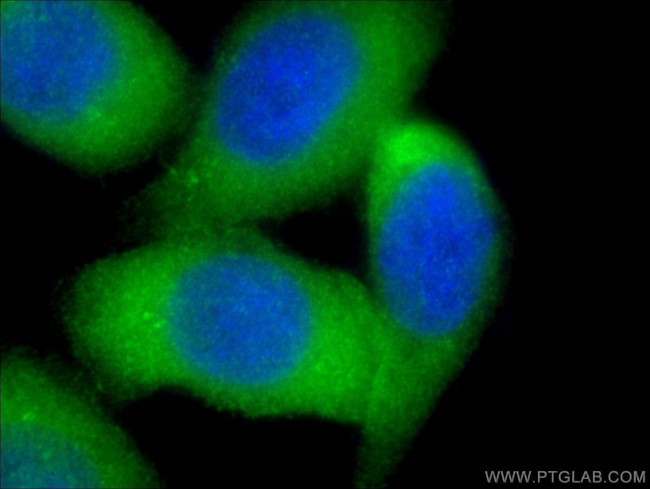 PKC iota Antibody in Immunocytochemistry (ICC/IF)