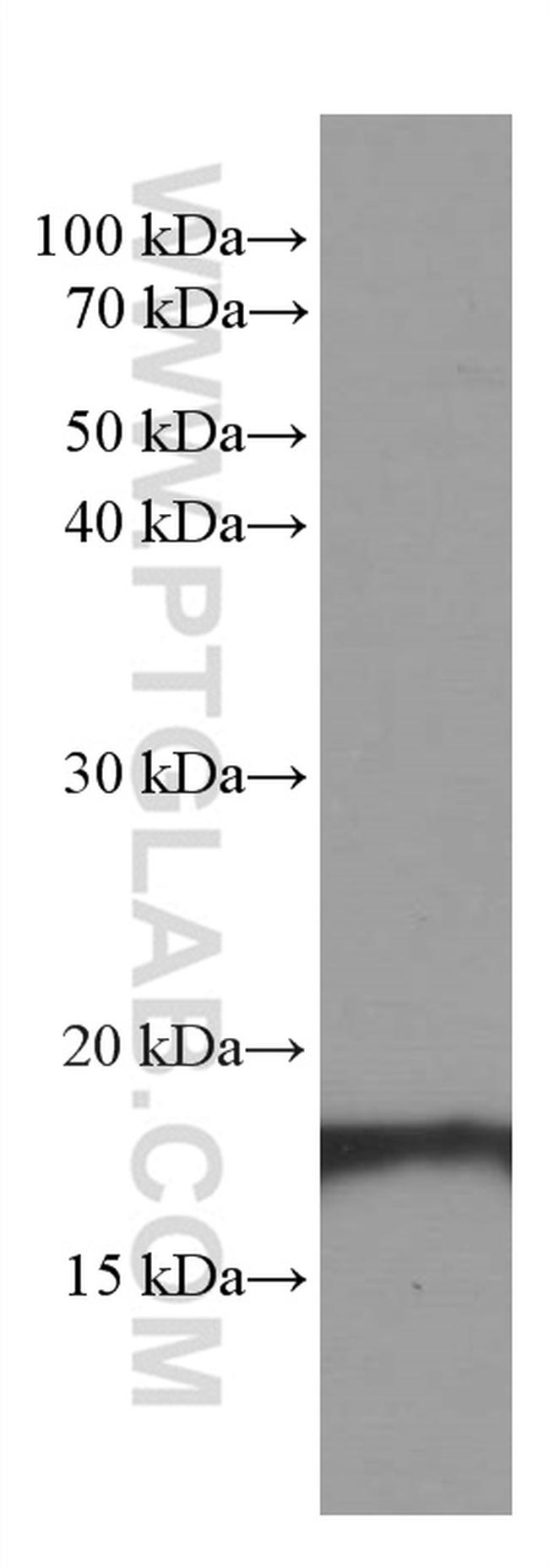 SURVIVIN Antibody in Western Blot (WB)