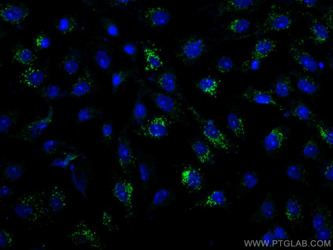 Calretinin Antibody in Immunocytochemistry (ICC/IF)