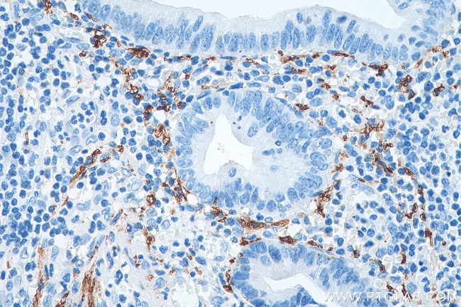 Calretinin Antibody in Immunohistochemistry (Paraffin) (IHC (P))