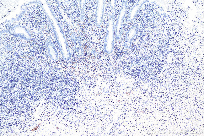 Calretinin Antibody in Immunohistochemistry (Paraffin) (IHC (P))