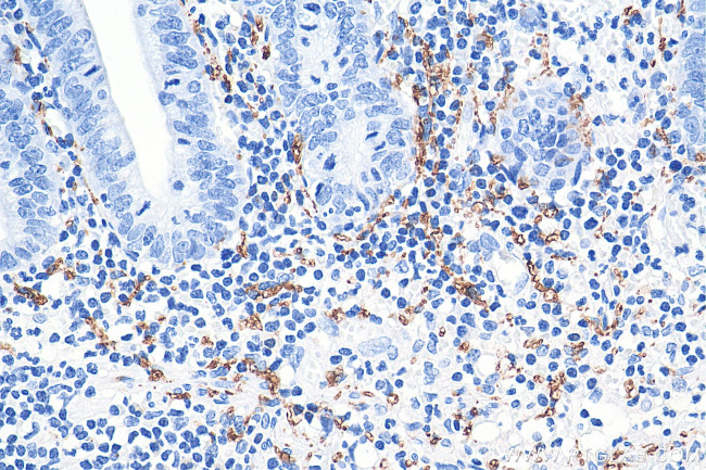 Calretinin Antibody in Immunohistochemistry (Paraffin) (IHC (P))