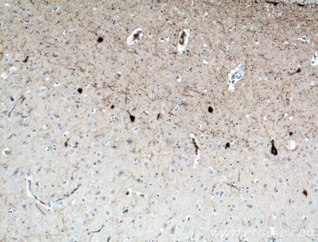 Calretinin Antibody in Immunohistochemistry (Paraffin) (IHC (P))