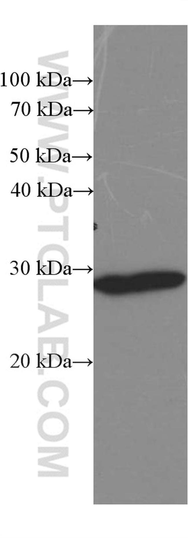 Calretinin Antibody in Western Blot (WB)