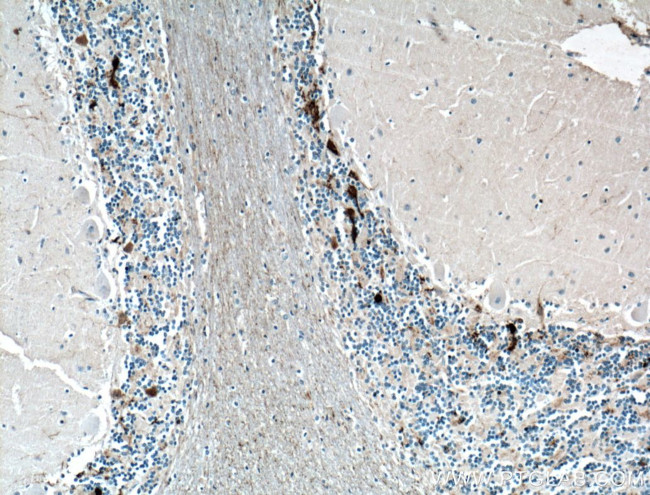 Calretinin Antibody in Immunohistochemistry (Paraffin) (IHC (P))