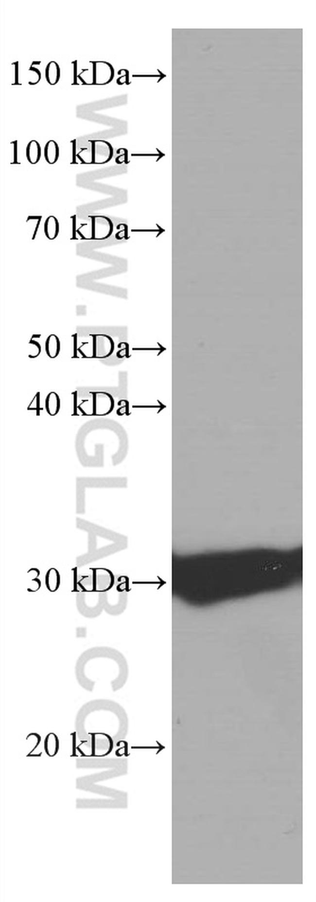 Calretinin Antibody in Western Blot (WB)