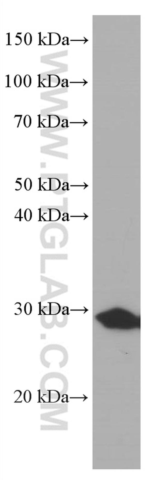 Calretinin Antibody in Western Blot (WB)