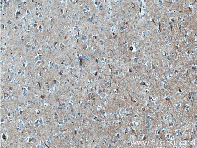 TAU Antibody in Immunohistochemistry (Paraffin) (IHC (P))