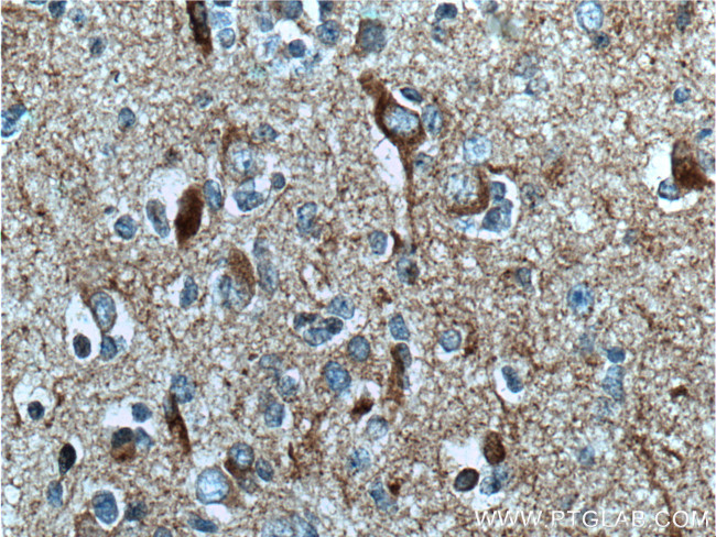 TAU Antibody in Immunohistochemistry (Paraffin) (IHC (P))