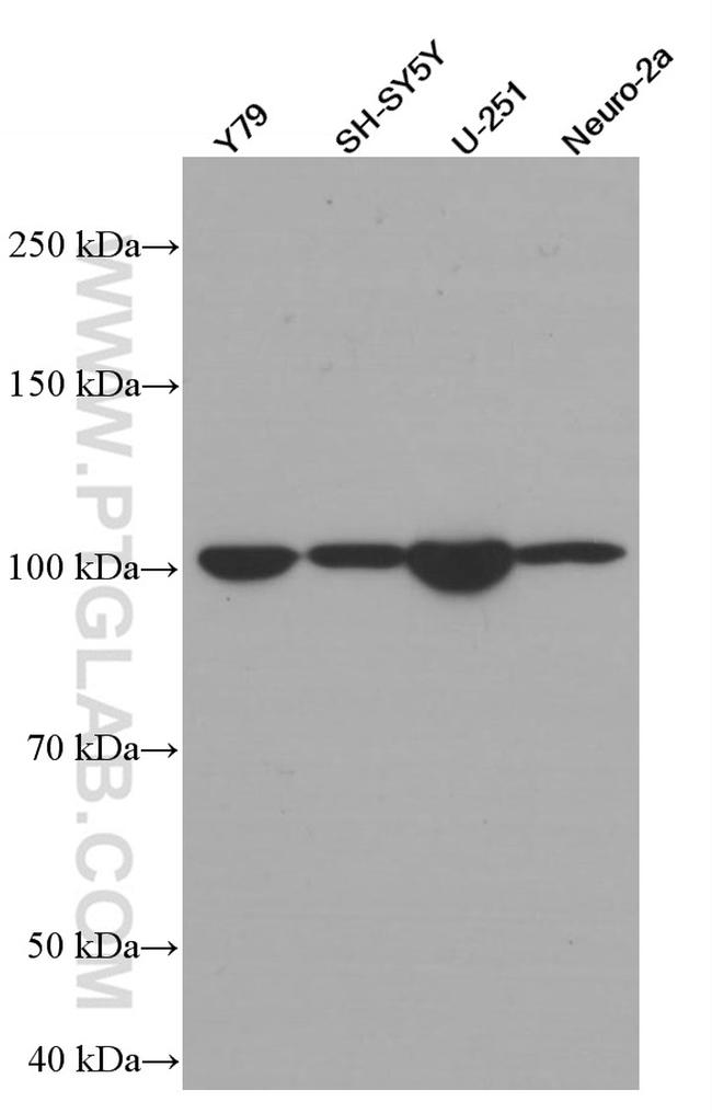 TAU Antibody in Western Blot (WB)