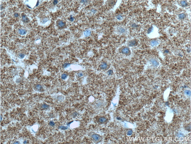 TAU Antibody in Immunohistochemistry (Paraffin) (IHC (P))