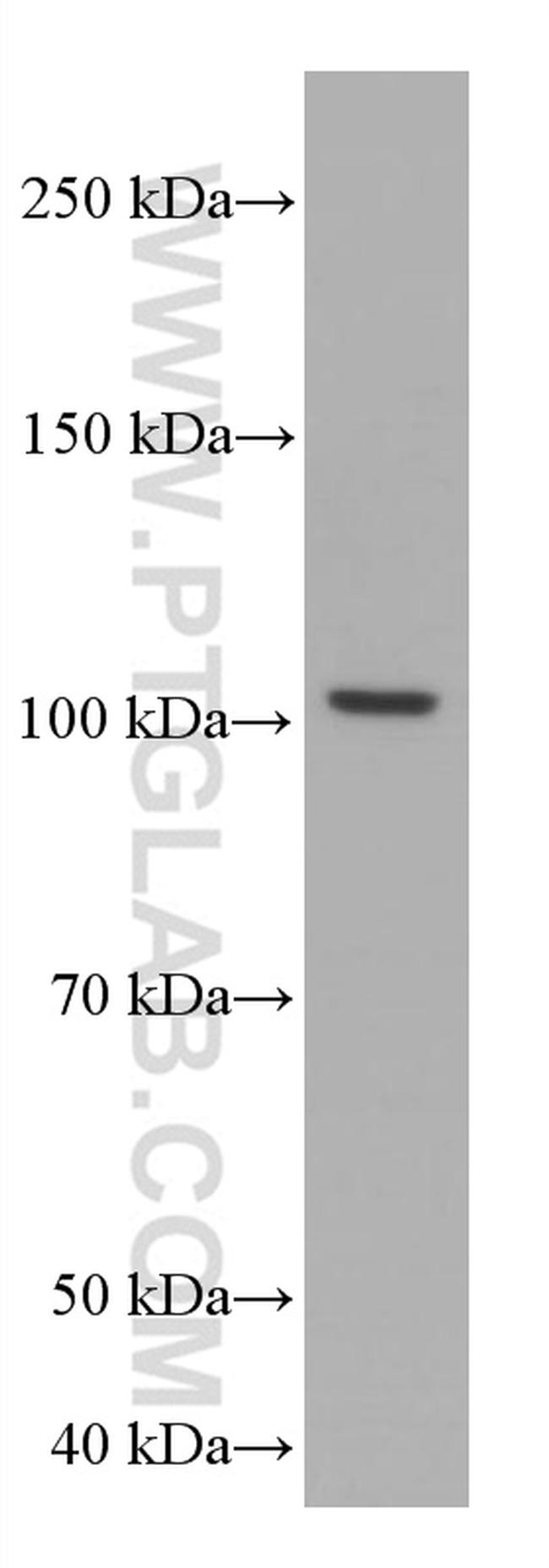 TAU Antibody in Western Blot (WB)