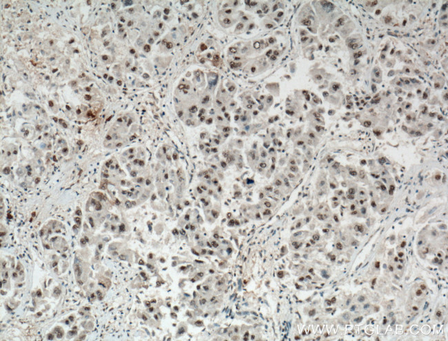 TAZ Antibody in Immunohistochemistry (Paraffin) (IHC (P))