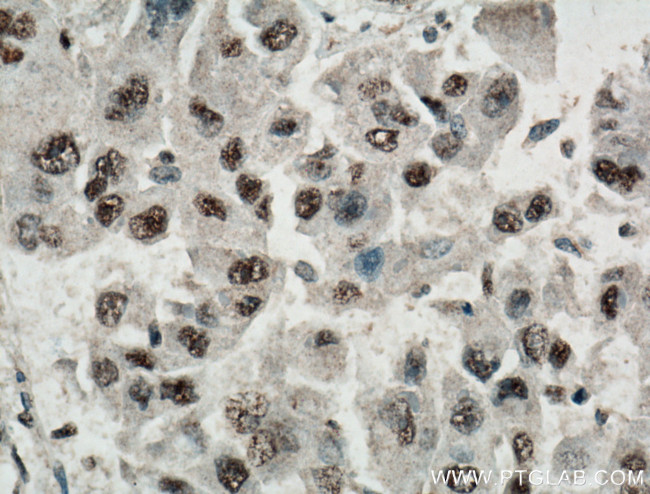 TAZ Antibody in Immunohistochemistry (Paraffin) (IHC (P))