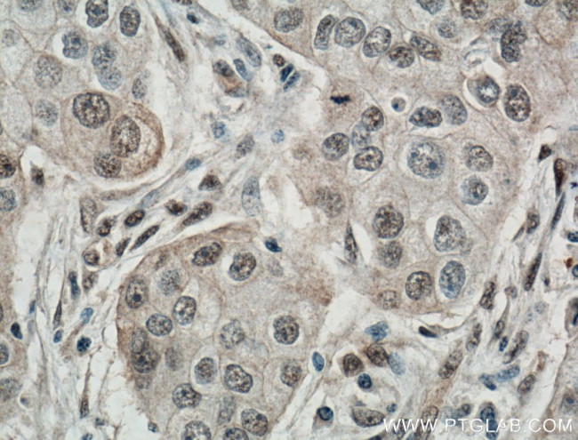 TAZ Antibody in Immunohistochemistry (Paraffin) (IHC (P))