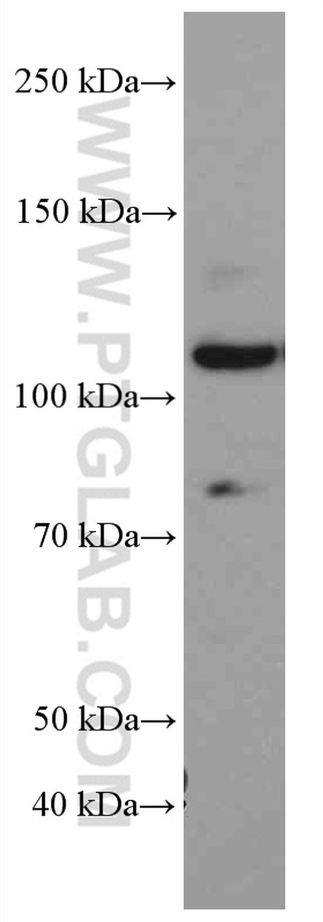 MYPT1 Antibody in Western Blot (WB)