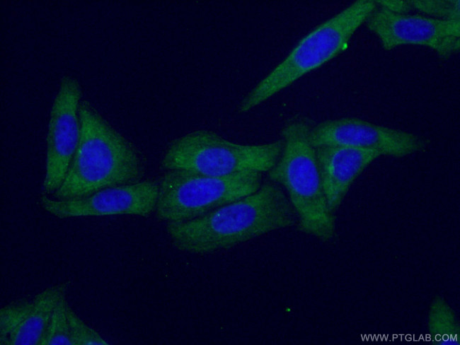 CNOT1 Antibody in Immunocytochemistry (ICC/IF)