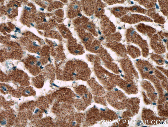 CNOT1 Antibody in Immunohistochemistry (Paraffin) (IHC (P))