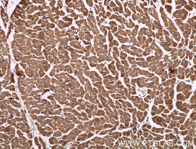 CNOT1 Antibody in Immunohistochemistry (Paraffin) (IHC (P))