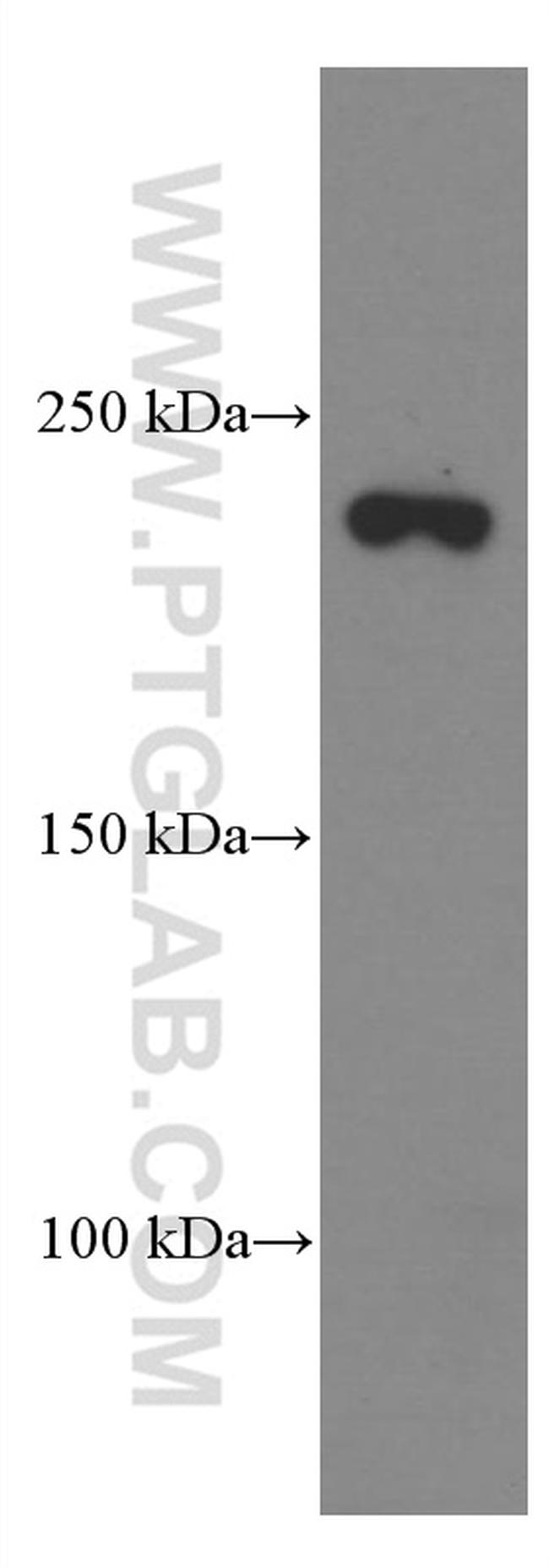 CNOT1 Antibody in Western Blot (WB)