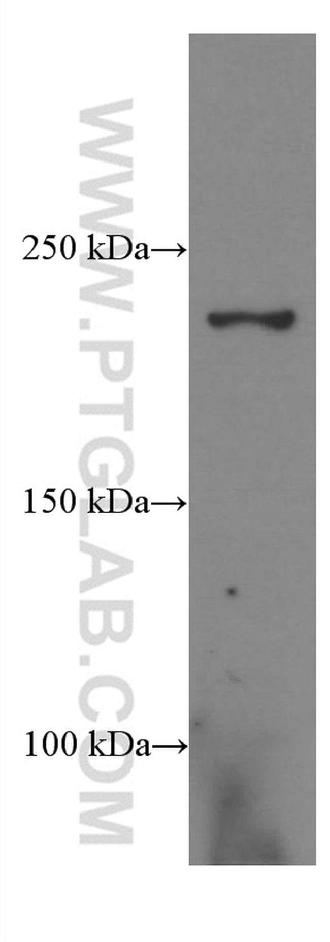 CNOT1 Antibody in Western Blot (WB)