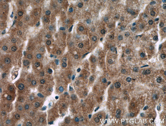 F2 Antibody in Immunohistochemistry (Paraffin) (IHC (P))