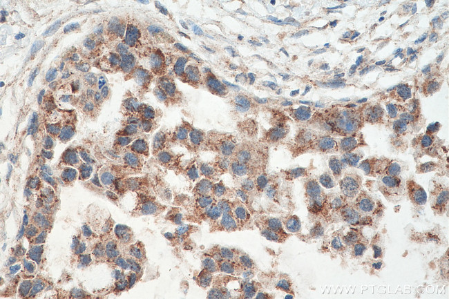 PYCR1 Antibody in Immunohistochemistry (Paraffin) (IHC (P))