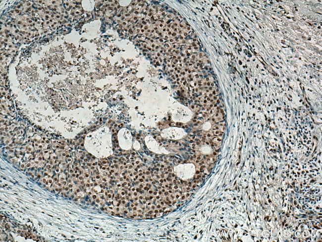 MDM2 Antibody in Immunohistochemistry (Paraffin) (IHC (P))