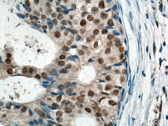 MDM2 Antibody in Immunohistochemistry (Paraffin) (IHC (P))