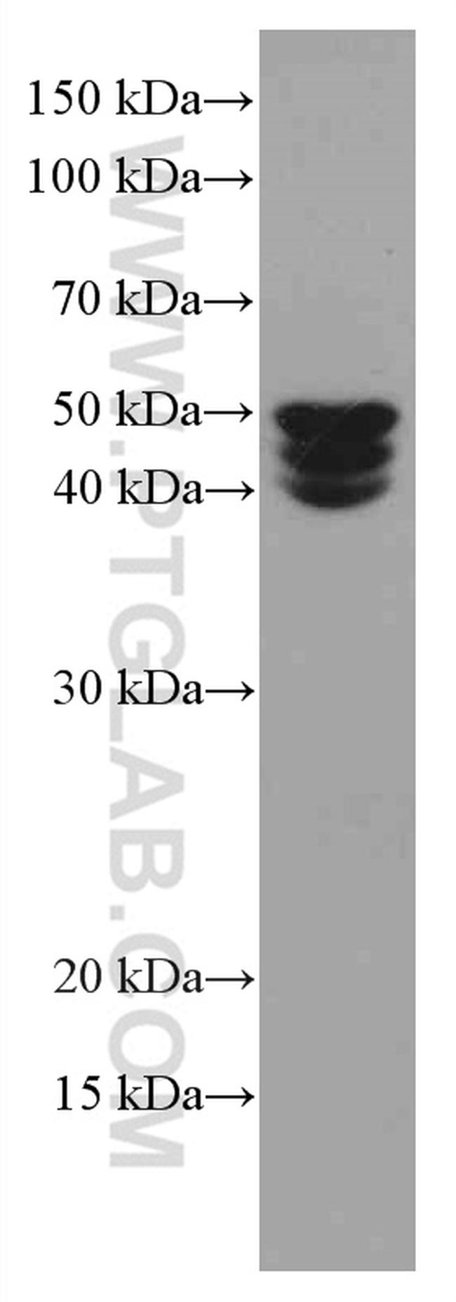 MDM2 Antibody in Western Blot (WB)