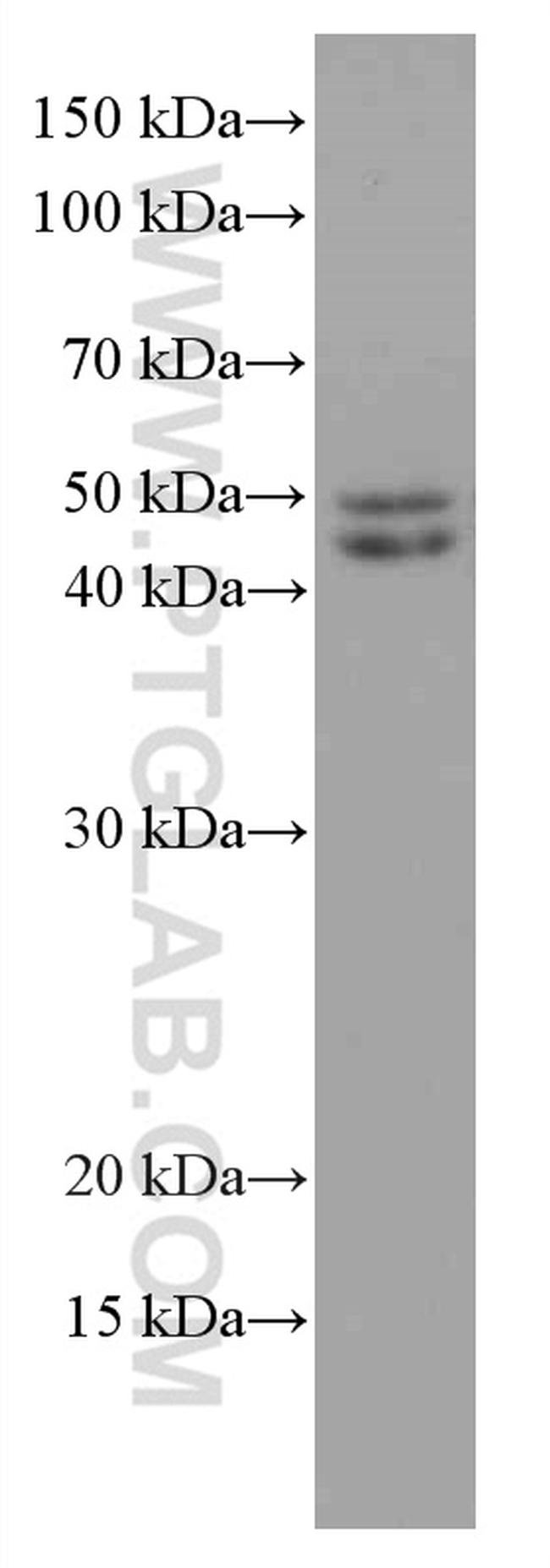 MDM2 Antibody in Western Blot (WB)