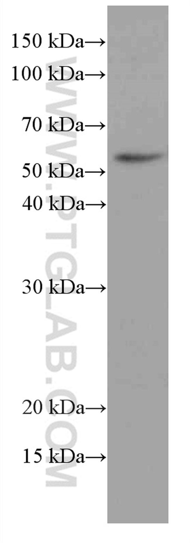 MDM2 Antibody in Western Blot (WB)