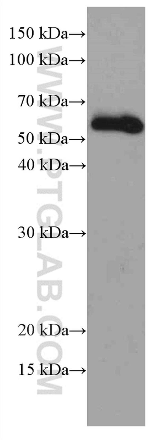 MDM2 Antibody in Western Blot (WB)